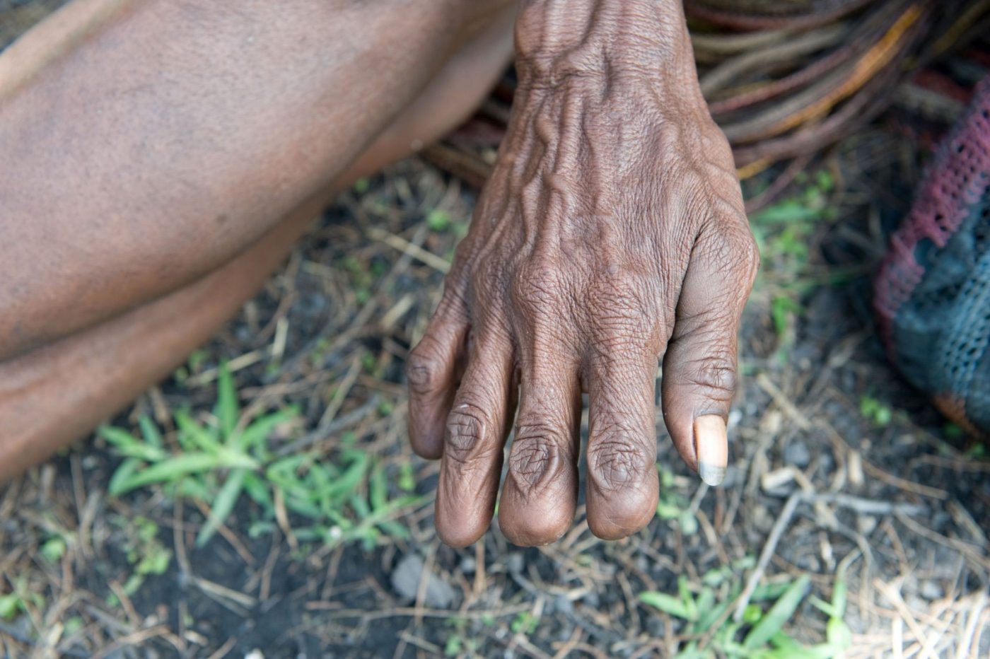 قطع الأصابع في اندونيسيا