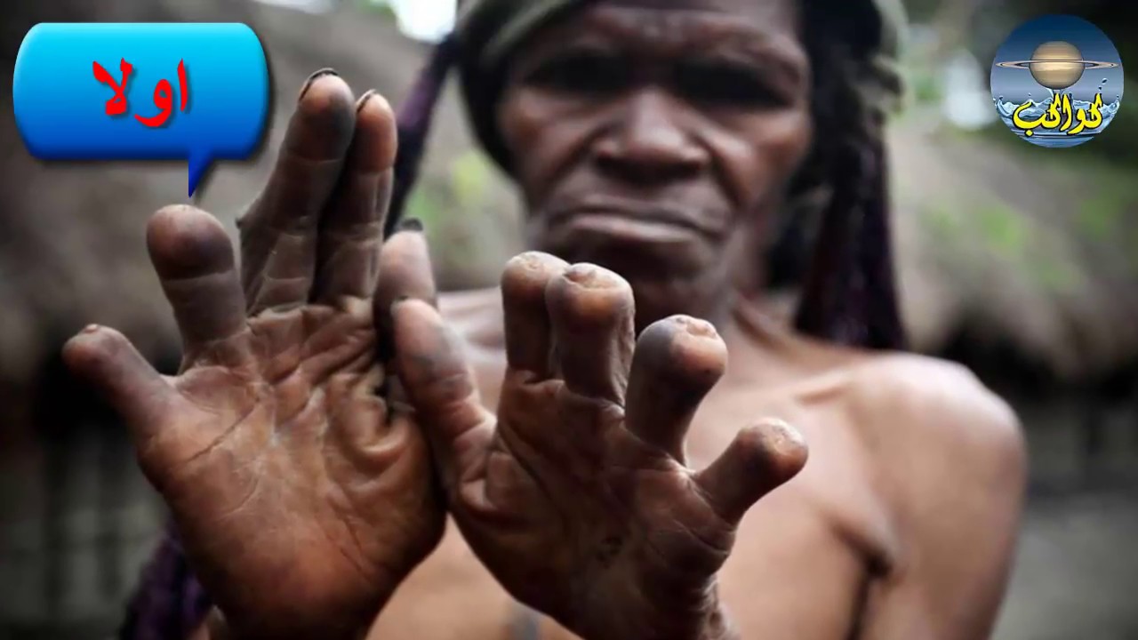 قطع الأصابع في اندونيسيا